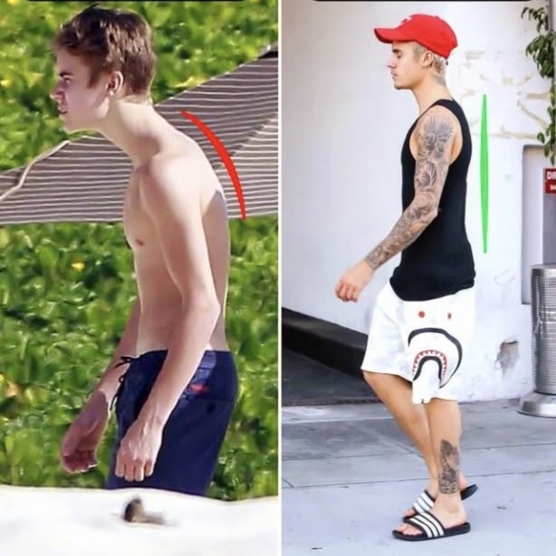 ADVINHE QUEM SE TRATOU COM QUIROPRAXIA?